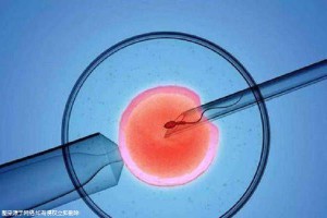怀代生包成功借卵生子